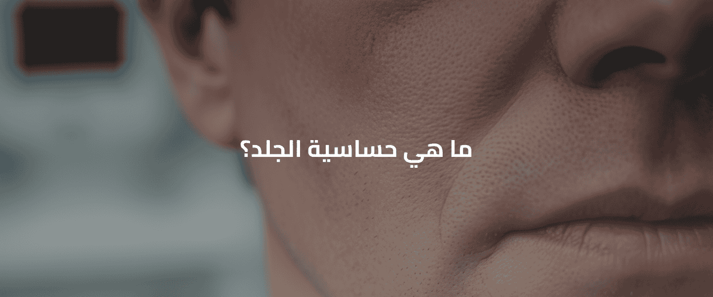 حساسية الجلد