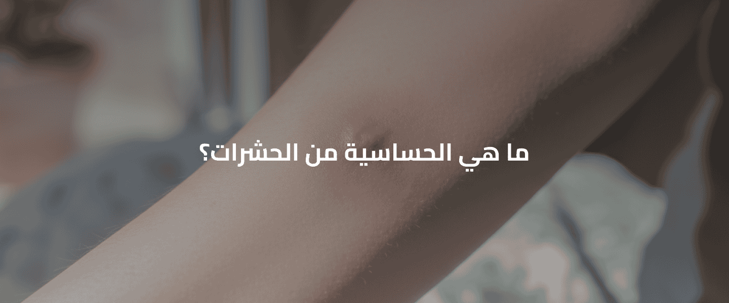 الحساسية من الحشرات