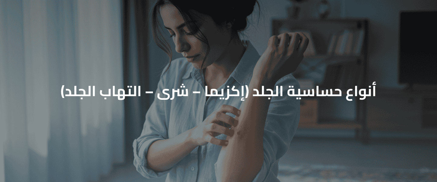 حساسية الجلد