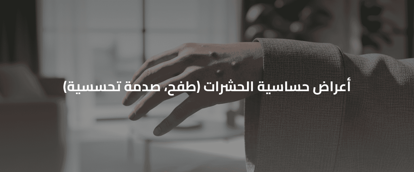 الحساسية من الحشرات