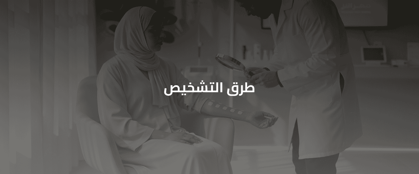 الحساسية من الحشرات