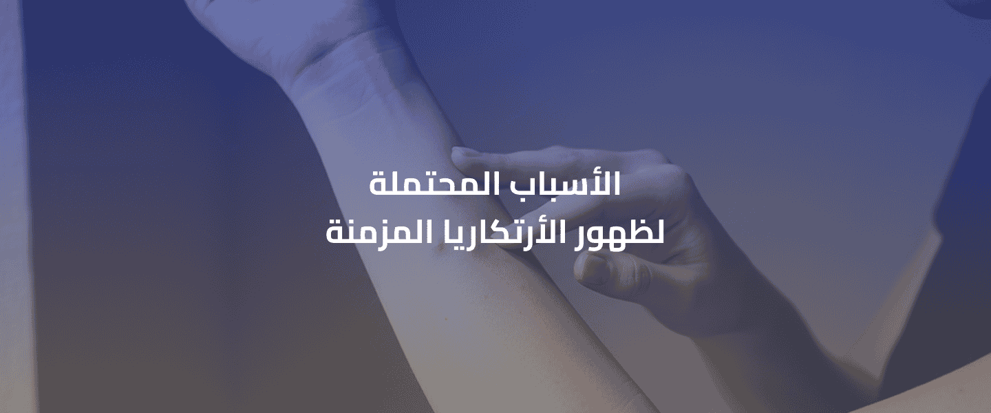 ظهور الأرتكاريا