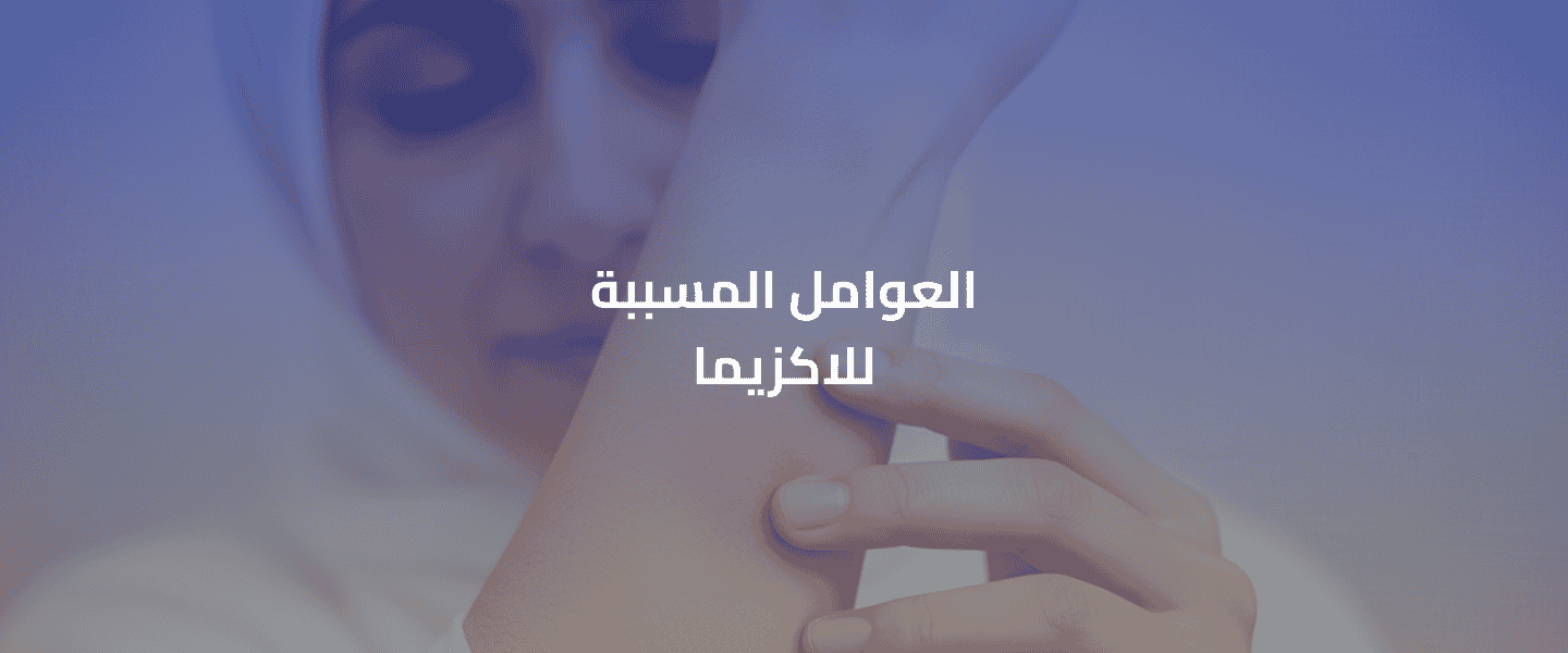 علاج الاكزيما