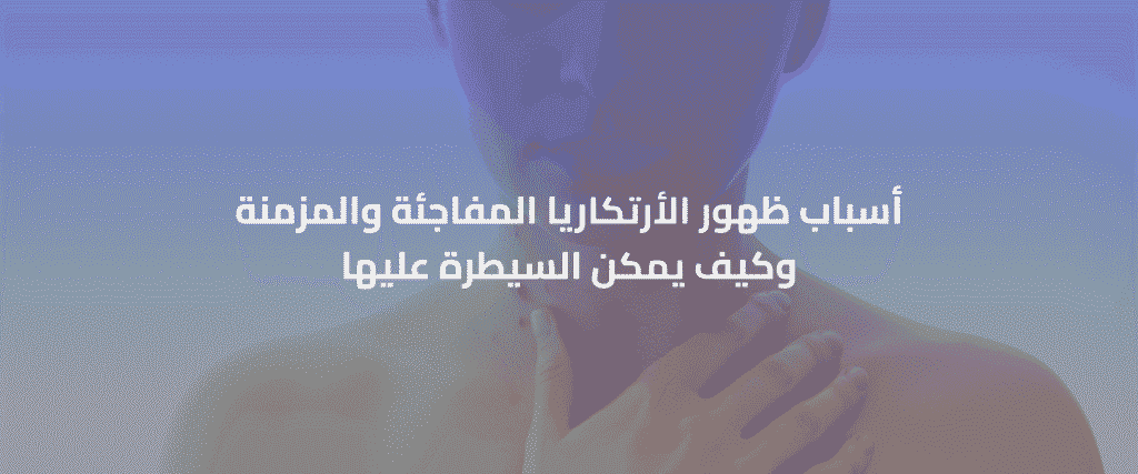 ظهور الأرتكاريا