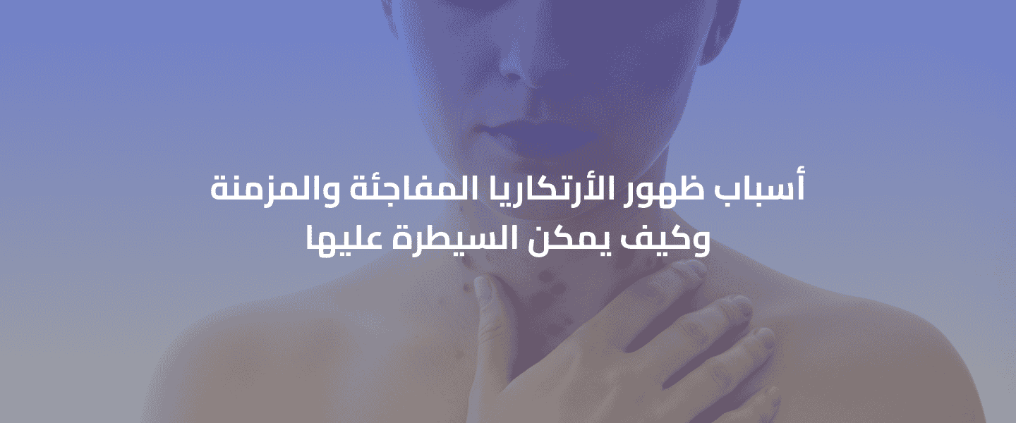 ظهور الأرتكاريا