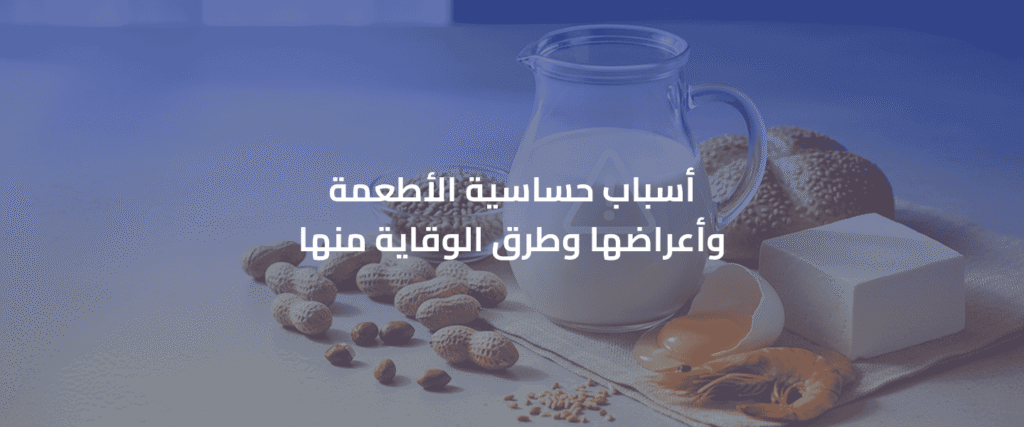 حساسية الأطعمة