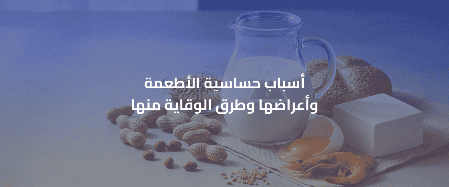 حساسية الأطعمة